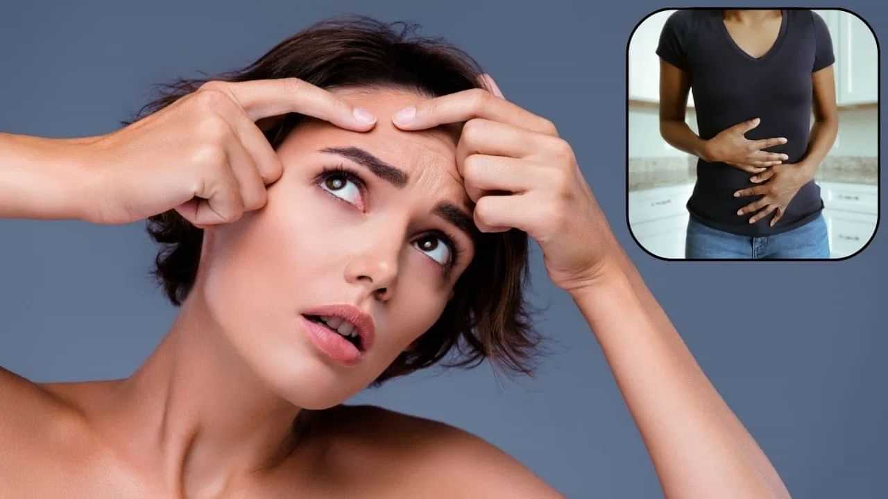 Skin Care: মুখত Pimple কিয় ওলায়? ইয়াক কেনেকৈ দূৰ কৰিব জানক