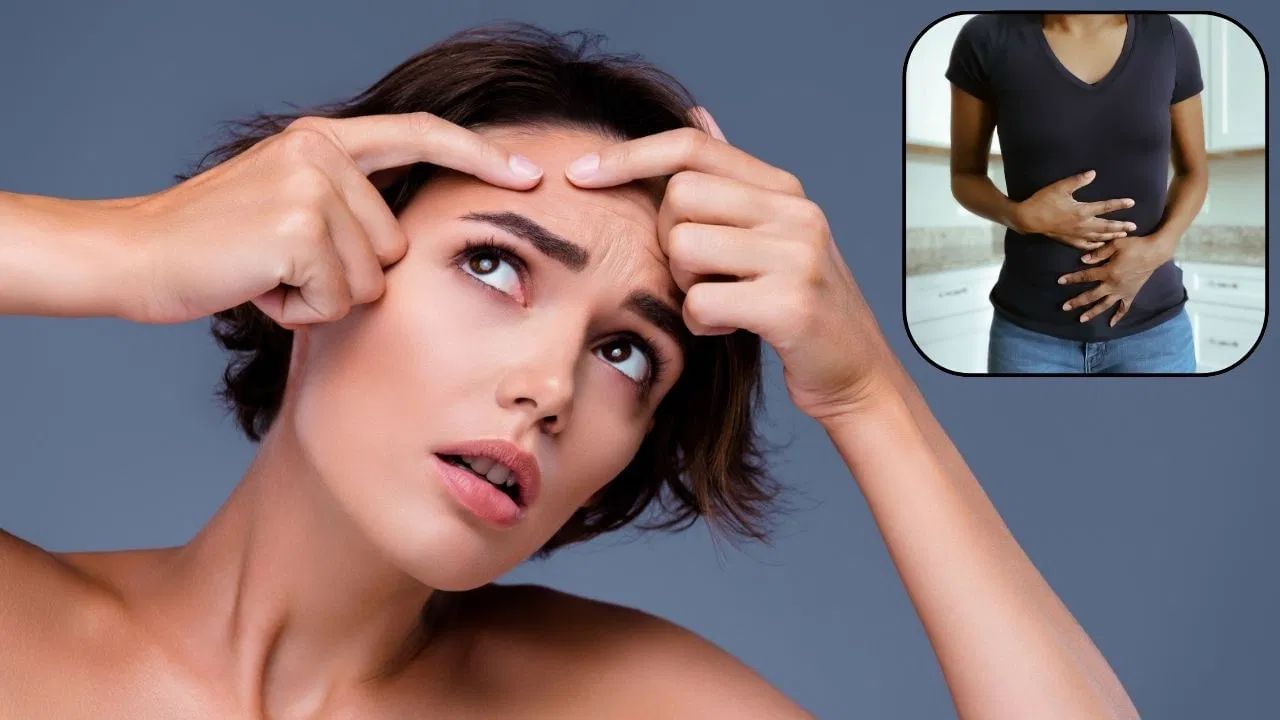 Skin Care: মুখত Pimple কিয় ওলায়? ইয়াক কেনেকৈ দূৰ কৰিব জানক Skin Care: মুখত Pimple কিয় ওলায়? ইয়াক কেনেকৈ দূৰ কৰিব জানক