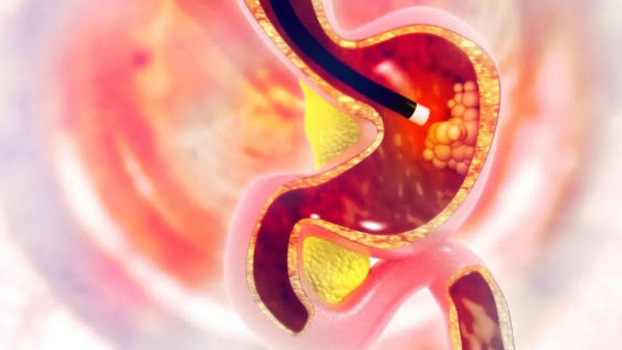 বিভিন্ন খাদ্যত জালুক ব্যৱহাৰ কৰা হয়। ই ৰন্ধা-বঢ়াৰ সোৱাদ বৃদ্ধি কৰে। কিন্তু ৰন্ধা সলনি কেঁচা জালুক খালে পেটৰ পৰা হাইড্ৰক্লৰিক এচিড উৎপন্ন হয়। ই শৰীৰত প্ৰ’টিন গলাত সহায় কৰে আৰু অন্ত্ৰ পৰিষ্কাৰ কৰে। ফলত এচিডিটিৰ সমস্যাৰ পৰা পৰিত্ৰাণ পাব পাৰে ।