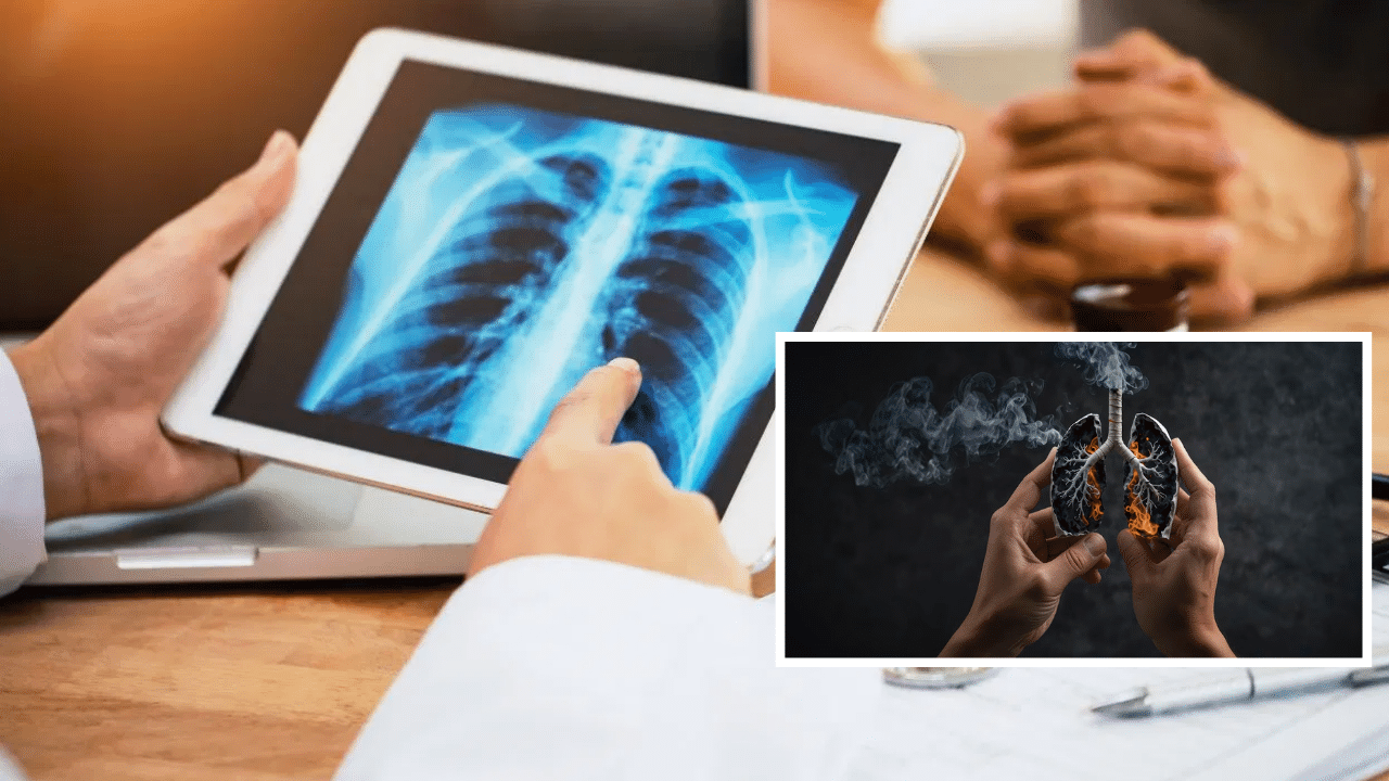 World Lung Cancer Day: কেৱল ধূমপান নহয়,এই কেইটা হ’ব পাৰে হাওঁফাওঁ কৰ্কট ৰোগৰ কাৰক