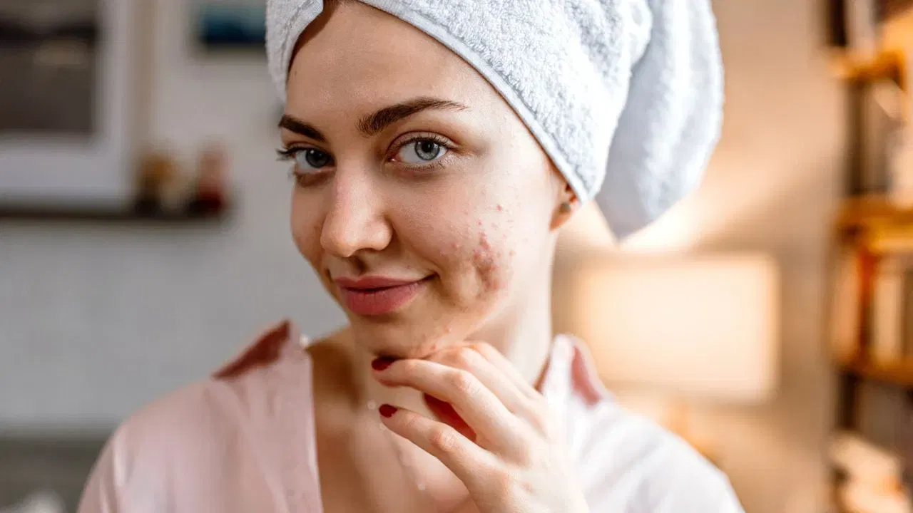 Skin Care Tips: প্ৰতিদিনে পুৱা ছালৰ বাবে কৰক ৪টা সহজ কাম, জিলিকি উঠিব আপুনি! Skin Care Tips: প্ৰতিদিনে পুৱা ছালৰ বাবে কৰক ৪টা সহজ কাম, জিলিকি উঠিব আপুনি!