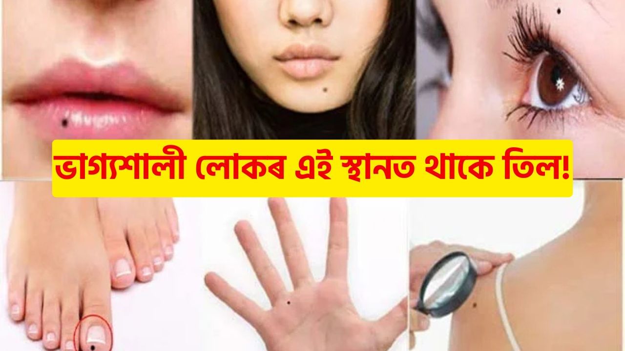 সৌভাগ্যশালী লোকৰ শৰীৰৰ এই স্থানত থাকে তিল! এনে লোকে লাভ কৰে মা লক্ষ্মীৰ আশীৰ্বাদ! সৌভাগ্যশালী লোকৰ শৰীৰৰ এই স্থানত থাকে তিল! এনে লোকে লাভ কৰে মা লক্ষ্মীৰ আশীৰ্বাদ!