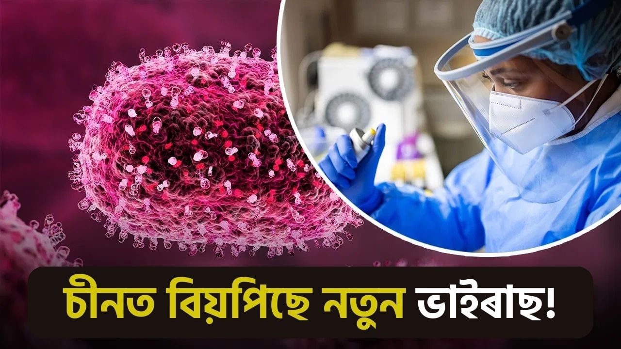 চীনত বিয়পিছে কৰ’না সদৃশ মাৰাত্মক ভাইৰাছ, বহু অঞ্চলত জৰুৰীকালীন অৱস্থা ঘোষণা! সবিশেষ জানক চীনত বিয়পিছে কৰ’না সদৃশ মাৰাত্মক ভাইৰাছ, বহু অঞ্চলত জৰুৰীকালীন অৱস্থা ঘোষণা! সবিশেষ জানক