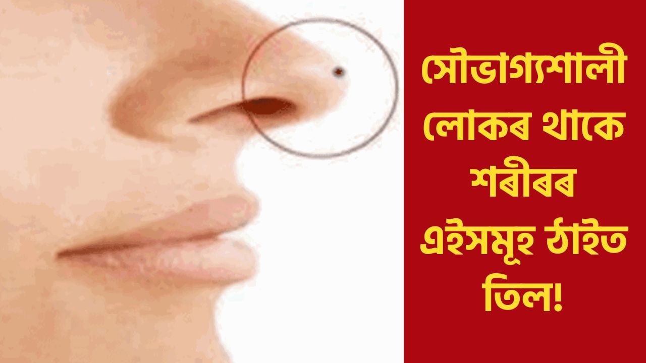 Mole sign meaning : শৰীৰৰ এইসমূহ ঠাইত তিল থকা মানেই সৌভাগ্যশালী হোৱাৰ লক্ষণ, জানক সবিশেষ Mole sign meaning : শৰীৰৰ এইসমূহ ঠাইত তিল থকা মানেই সৌভাগ্যশালী হোৱাৰ লক্ষণ, জানক সবিশেষ
