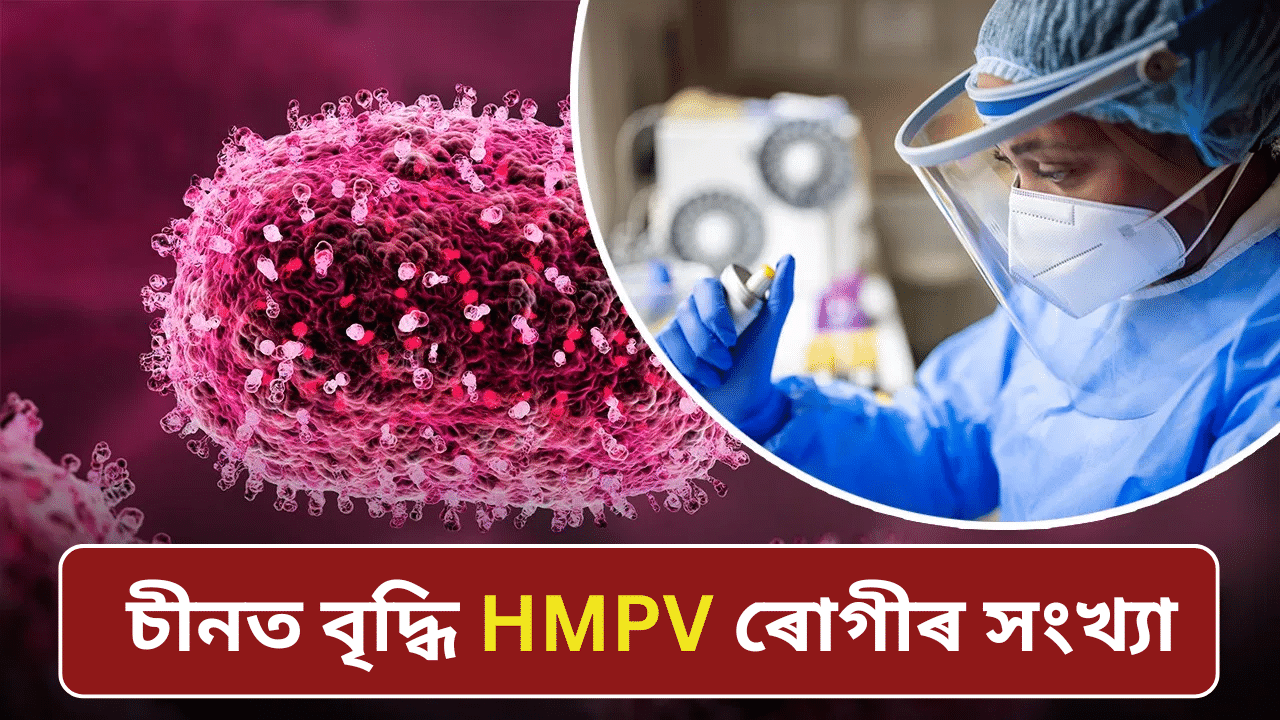 কোৰোনাৰ দৰে একে লক্ষণ! চীনত বৃদ্ধি HMPV ৰোগীৰ সংখ্যা, জানক এই ভাইৰাছৰ বিষয়ে… কোৰোনাৰ দৰে একে লক্ষণ! চীনত বৃদ্ধি HMPV ৰোগীৰ সংখ্যা, জানক এই ভাইৰাছৰ বিষয়ে…