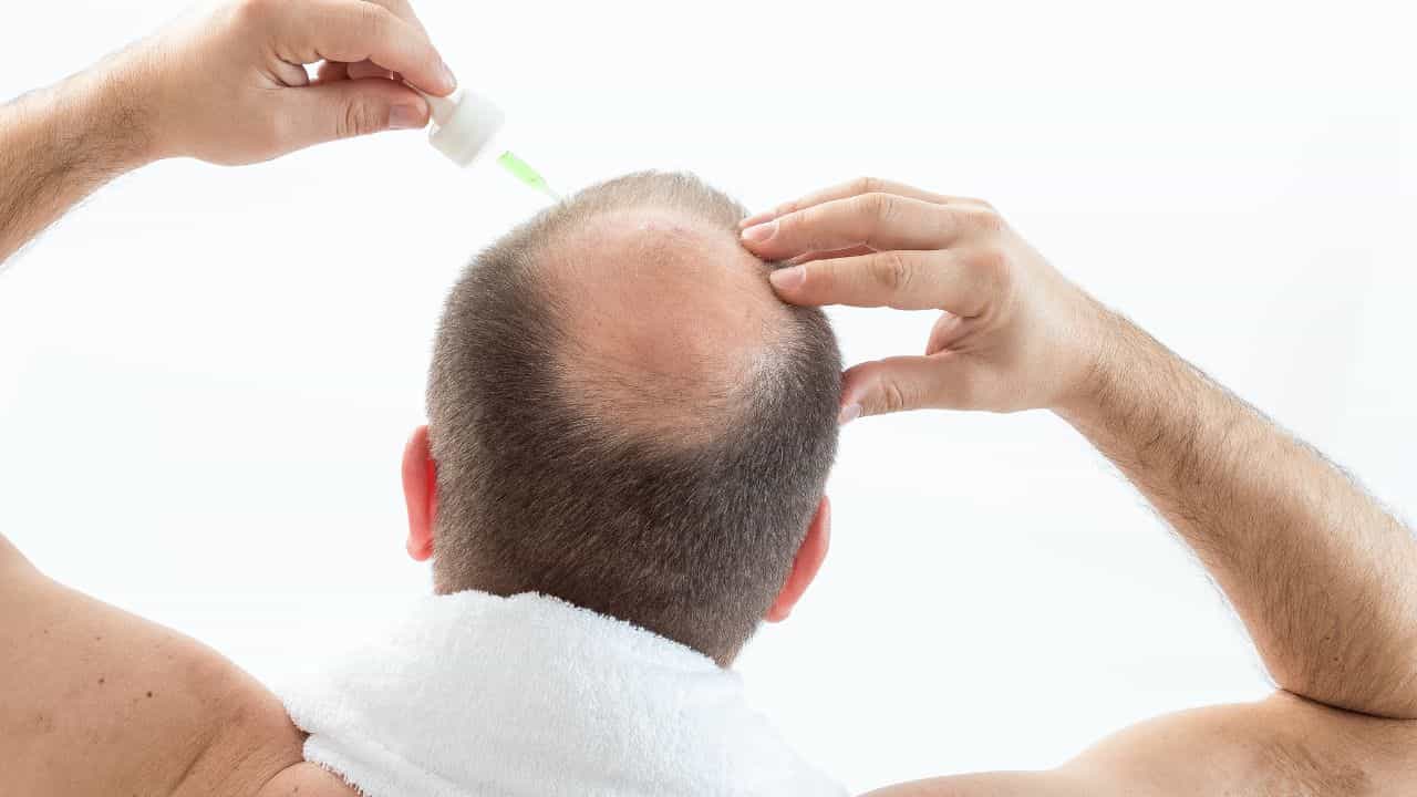 Hair Care Tips: মূৰৰ টকলা অংশত চুলি গজাবলৈ কি কৰিব ? জানক এটা ঘৰুৱা উপায়...