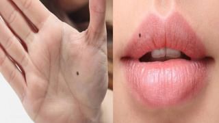 Mole sign: শৰীৰৰ এইসমূহ ঠাইত তিল থকা মানেই ধনী হোৱাৰ লক্ষণ!