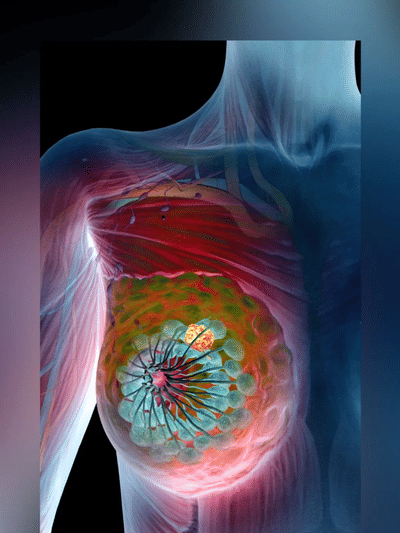 স্তনৰ আকাৰ,  স্তন ৰঙা পৰা… ভুলতো এই লক্ষণসমূহ আওকাণ নকৰিব!