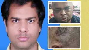 Kanpur 1