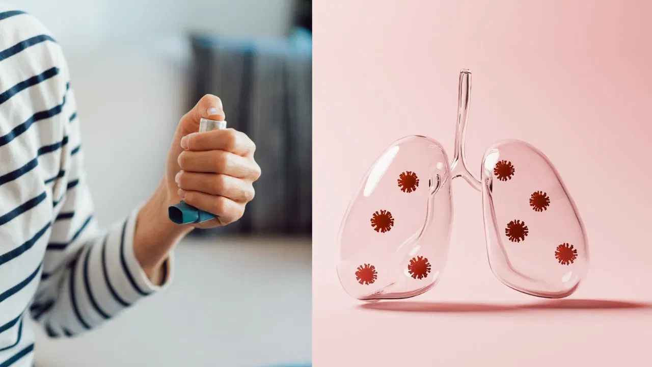 Asthma: হাঁপানী ৰোগ সম্পূৰ্ণৰূপে নিৰাৰময় কৰিব পাৰিনে? চিকিৎসকে কি কয় জানক… Asthma: হাঁপানী ৰোগ সম্পূৰ্ণৰূপে নিৰাৰময় কৰিব পাৰিনে? চিকিৎসকে কি কয় জানক…
