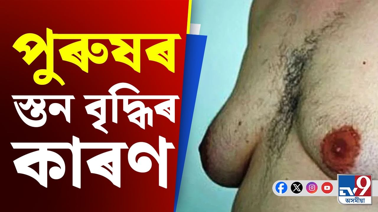 কিয় ডাঙৰ হৈ যায় পুৰুষৰ স্তন? ইয়াৰ আঁৰৰ কাৰণ, নিয়ন্ত্ৰণৰ উপায় জানক...