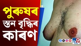কিয় ডাঙৰ হৈ যায় পুৰুষৰ স্তন? ইয়াৰ আঁৰৰ কাৰণ, নিয়ন্ত্ৰণৰ উপায় জানক… কিয় ডাঙৰ হৈ যায় পুৰুষৰ স্তন? ইয়াৰ আঁৰৰ কাৰণ, নিয়ন্ত্ৰণৰ উপায় জানক…...