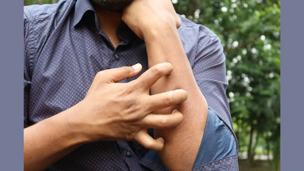 Fungal infection: বৰষুণৰ বতৰত ছালৰ সংক্ৰমণৰ পৰা নিজক কেনেদৰে ৰক্ষা কৰিব? জানক সহজ উপায়… Fungal infection: বৰষুণৰ বতৰত ছালৰ সংক্ৰমণৰ পৰা নিজক কেনেদৰে ৰক্ষা কৰিব? জানক সহজ উপায়…