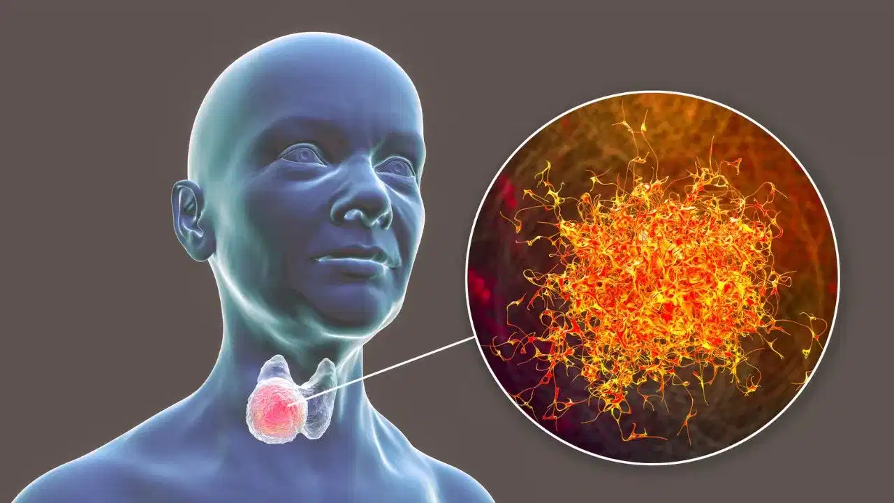 থাইৰয়ডৰ সমস্যা হলে কি কি খাব লাগে, কি নালাগে, জানক সকলো... থাইৰয়ডৰ সমস্যা হলে কি কি খাব লাগে, কি নালাগে, জানক সকলো...