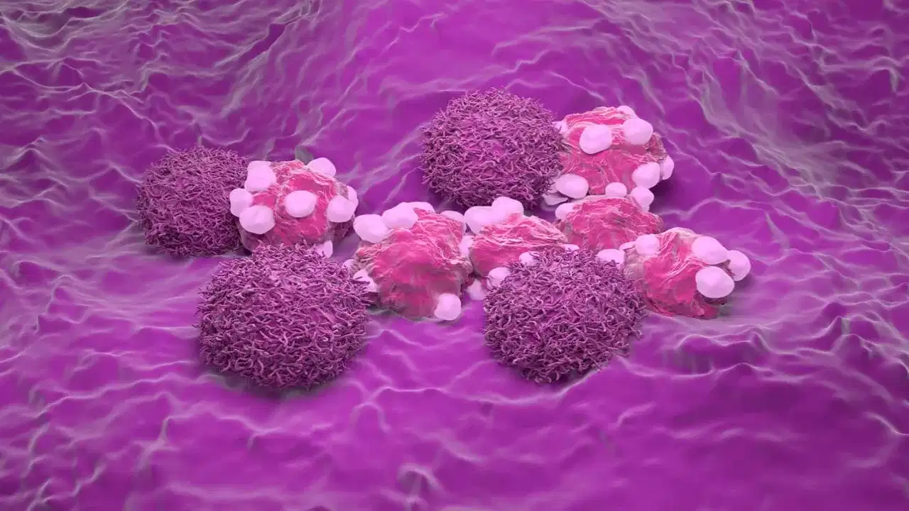 কোনসকল মহিলাৰ ছাৰ্ভাইকেল কৰ্কট ৰোগ হোৱাৰ আশংকা বেছি? জানক...