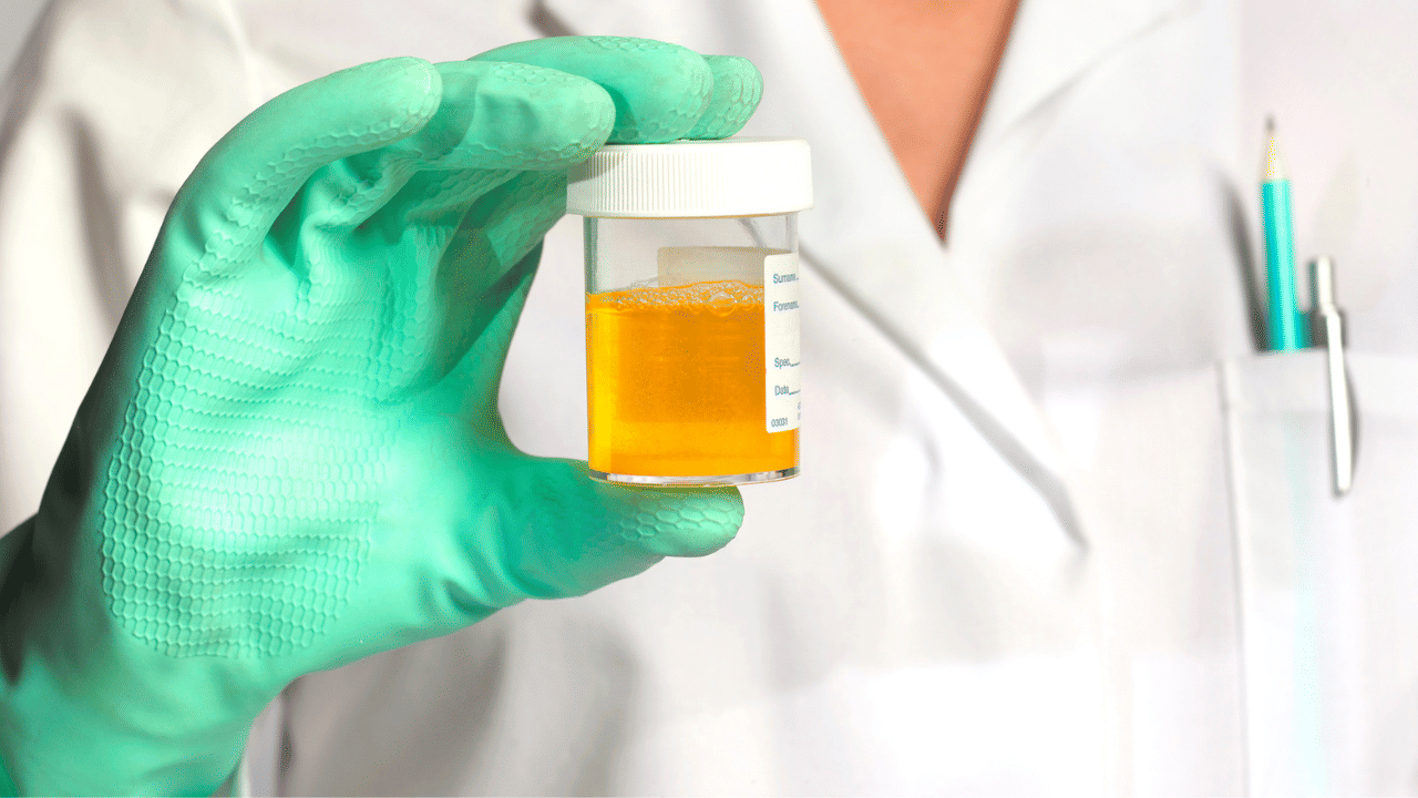 প্ৰস্ৰাৱত অধিক ফেন আহে নেকি? নকৰিব আওকান, হব পাৰে এইসমূহ গুৰুতৰ ৰোগৰ লক্ষণ...