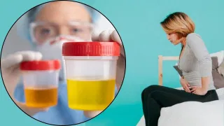 বাৰে বাৰে প্ৰস্ৰাৱৰ সংক্ৰমণ কিয় হয়? ইয়াৰ প্ৰধান কাৰণ, প্ৰতিকাৰৰ উপায় জানক…