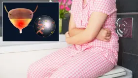 স্পাচমোডিক ডিছমেন’ৰিয়া কি?