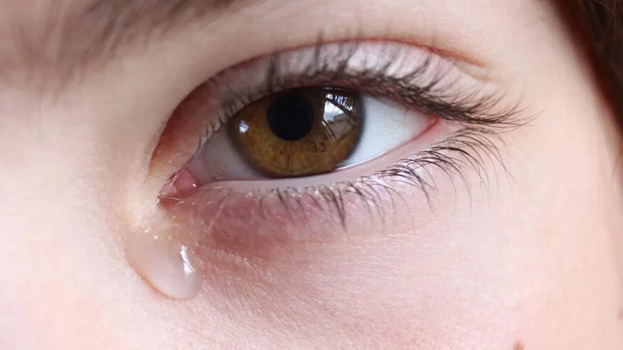 Watery Eyes Problem: চকুৰ পৰা বাৰে বাৰে পানী ওলাই থাকে নেকি? ই কি ৰোগৰ কাৰণ, জানক… Watery Eyes Problem: চকুৰ পৰা বাৰে বাৰে পানী ওলাই থাকে নেকি? ই কি ৰোগৰ কাৰণ, জানক…