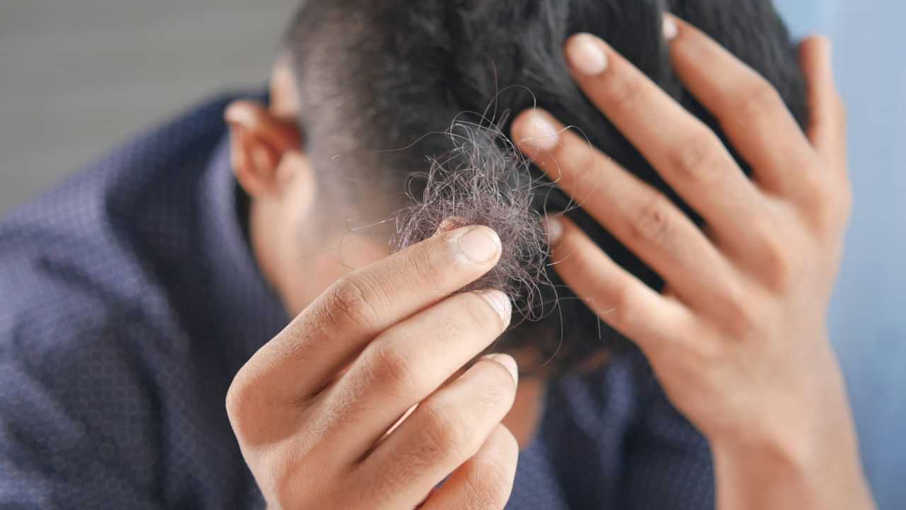অত্যধিক মানসিক চাপৰ বাবে সঁচাকৈয়ে চুলি সৰেনে? বিশেষজ্ঞই কি কয় চাওক...