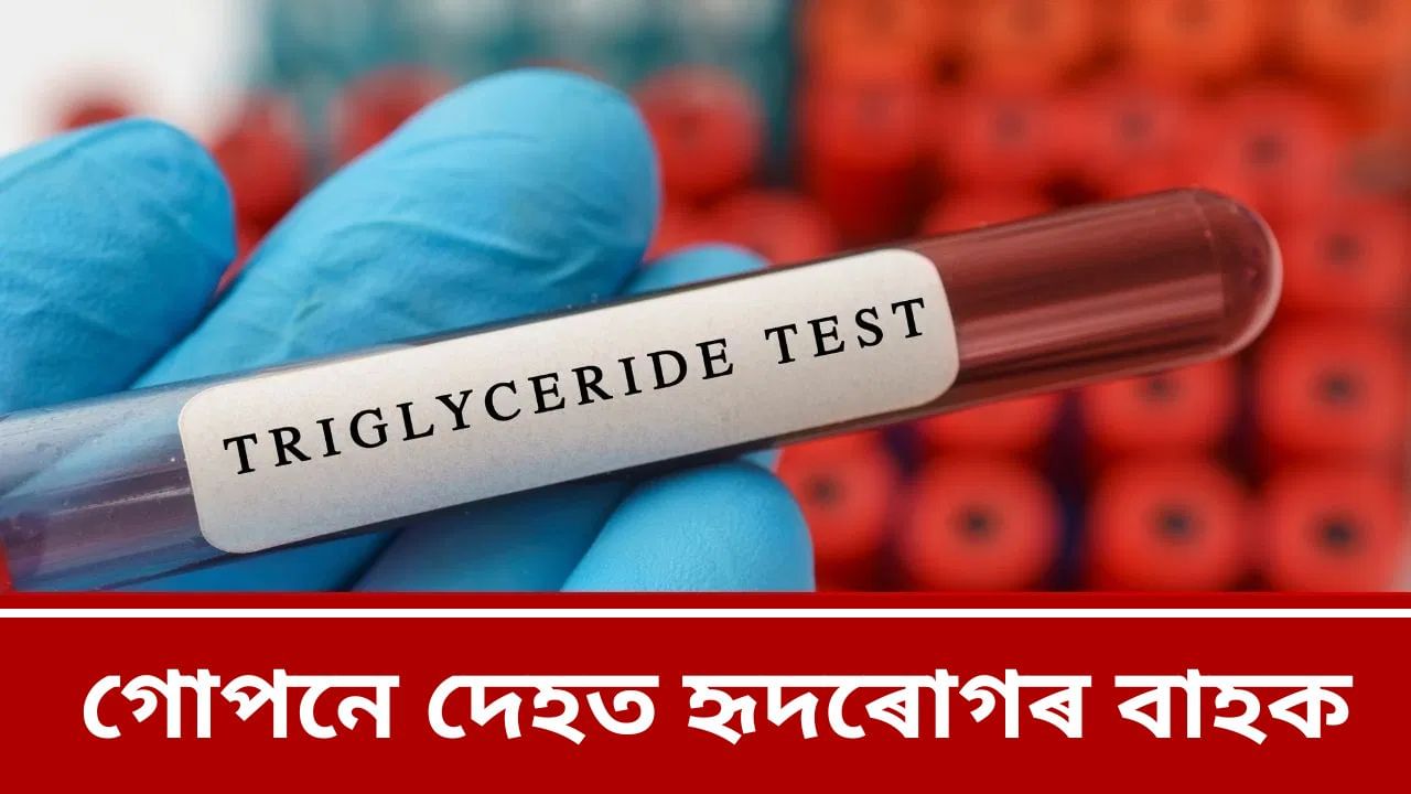 ট্ৰাইগ্লিচাৰাইডে কিদৰে শিশু আৰু কিশোৰ-কিশোৰীৰ ক্ষেত্ৰত বৃদ্ধি কৰিছে হৃদৰোগৰ সমস্যা? জানক সবিশেষ