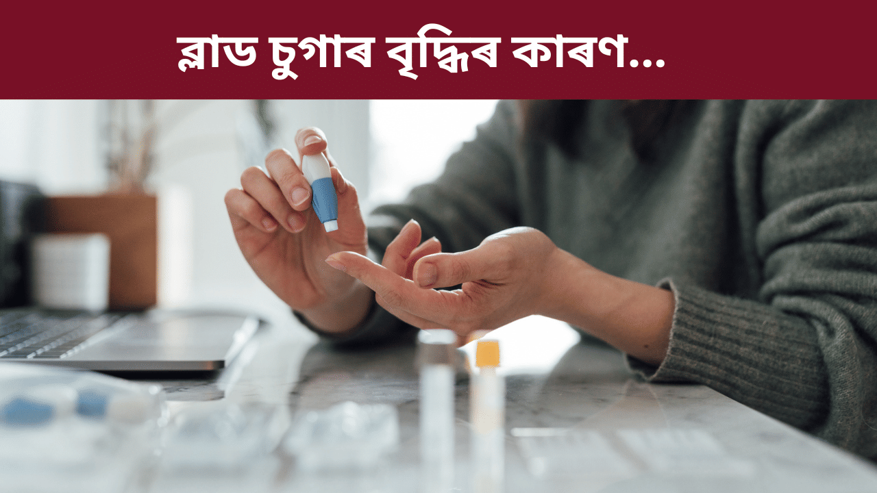 শীতকালত কিয় বৃদ্ধি পাই ব্লাড চুগাৰ? ইয়াৰ লক্ষণ কি, জানক চিকিৎসকৰ পৰা… শীতকালত কিয় বৃদ্ধি পাই ব্লাড চুগাৰ? ইয়াৰ লক্ষণ কি, জানক চিকিৎসকৰ পৰা…