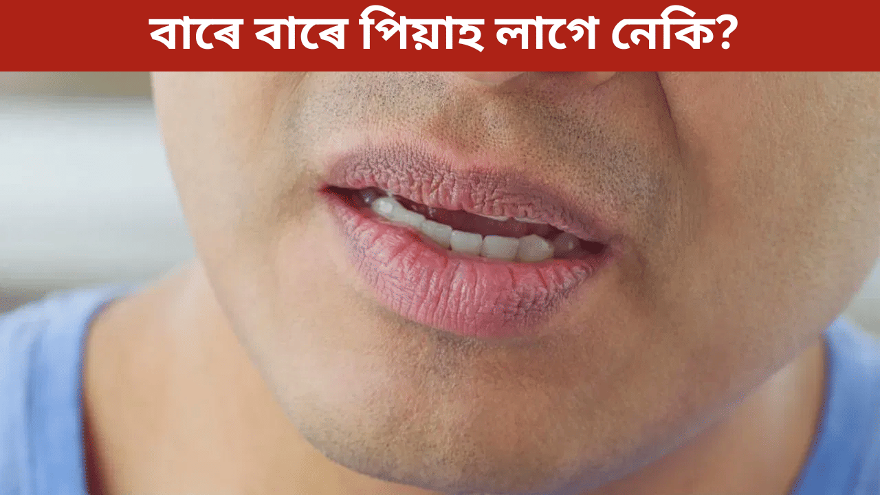 মুখ শুকাই যোৱা, পিয়াহ লগা…পুৱাৰ সময়ত দেখা দিয়া এই লক্ষণ হ’ব পাৰে ডাঙৰ সমস্যাৰ ইংগিত, জানক… মুখ শুকাই যোৱা, পিয়াহ লগা…পুৱাৰ সময়ত দেখা দিয়া এই লক্ষণ হ’ব পাৰে ডাঙৰ সমস্যাৰ ইংগিত, জানক…