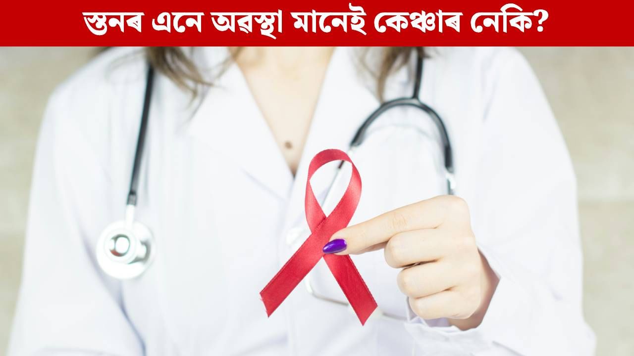 স্তনৰ এনে অৱস্থাও হ’ব পাৰে নেকি কেঞ্চাৰৰ লক্ষণ! বিশেষজ্ঞই পৰামৰ্শই সতৰ্ক কৰিব আপোনাক স্তনৰ এনে অৱস্থাও হ’ব পাৰে নেকি কেঞ্চাৰৰ লক্ষণ! বিশেষজ্ঞই পৰামৰ্শই সতৰ্ক কৰিব আপোনাক