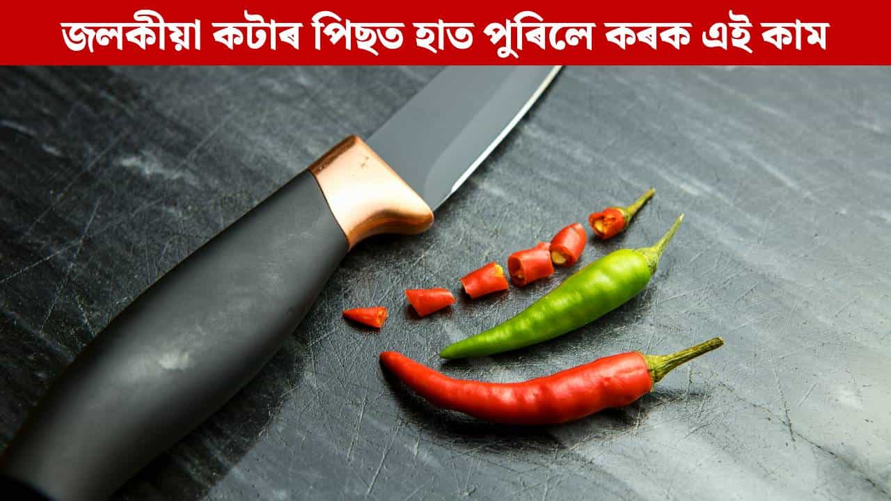 জলকীয়া কাটি হাত ধোৱাৰ পিছতো কমা নাই নেকি জ্বলা-পোৰা? কৰক এই কাম, পাব সকাহ