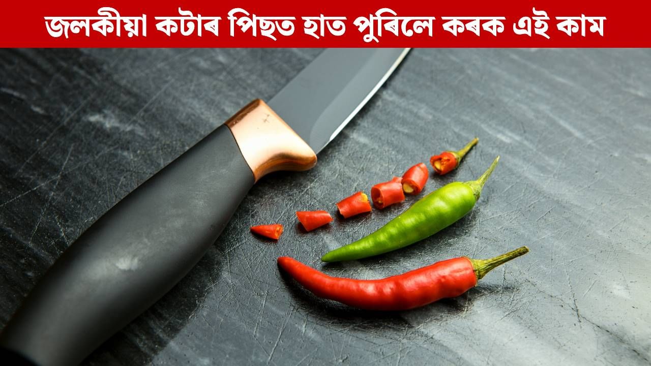জলকীয়া কাটি হাত ধোৱাৰ পিছতো কমা নাই নেকি জ্বলা-পোৰা? কৰক এই কাম, পাব সকাহ