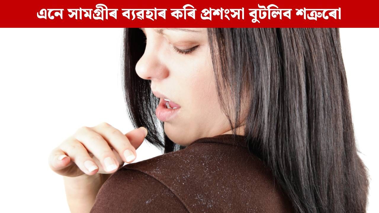 চুলিৰ মিত্ৰ, পিছে উফিৰ ‘কাল’; এই ৫বিধ সামগ্ৰীৰ ব্যৱহাৰ কৰি শত্ৰুৰো প্ৰশংসা বুটলিব আপুনি চুলিৰ মিত্ৰ, পিছে উফিৰ ‘কাল’; এই ৫বিধ সামগ্ৰীৰ ব্যৱহাৰ কৰি শত্ৰুৰো প্ৰশংসা বুটলিব আপুনি