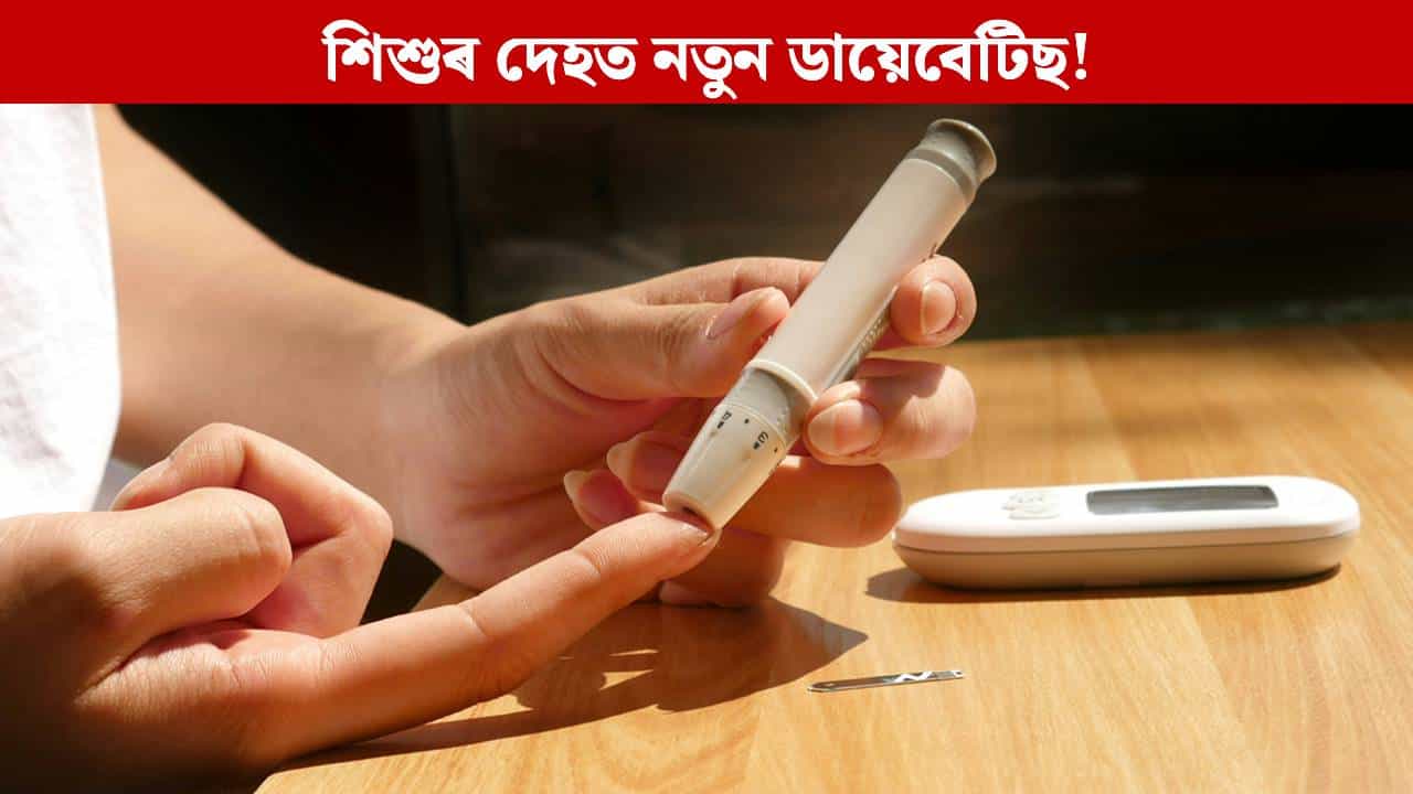 আৱিষ্কাৰ হৈছে শিশুৰ দেহৰ নতুন ডায়েবেটিছ, চাওক কি কৈছে বিশেষজ্ঞই