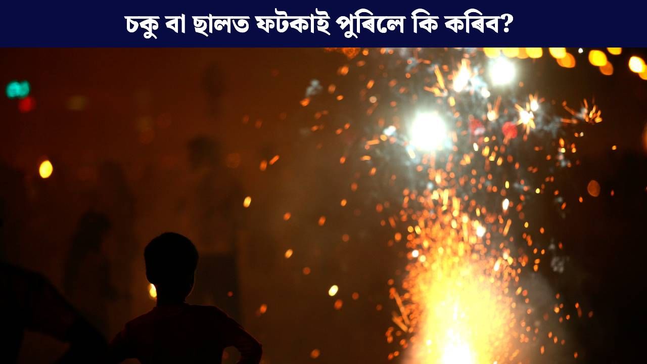 ভুলতো নলগাব টুথপেষ্ট, নিদিব ঘঁহি! চকু বা ছালত ফটকাই পুৰিলে কি কৰিব? জানক চিকিৎসকৰ পৰা… ভুলতো নলগাব টুথপেষ্ট, নিদিব ঘঁহি! চকু বা ছালত ফটকাই পুৰিলে কি কৰিব? জানক চিকিৎসকৰ পৰা…