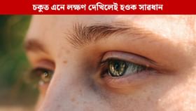 চকুৰ শুকান হৈ পৰা সমস্যাক নকৰিব উলাই, এনে লক্ষণে দেখিলেই সাৱধান চকুৰ শুকান হৈ পৰা সমস্যাক নকৰিব উলাই, এনে লক্ষণে দেখিলেই সাৱধান