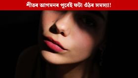 শীতত ফটা ওঁঠৰ সমস্যাৰ পৰা সকাহ পাবলৈ এইদৰে লওক সঠিক যত্ন শীতত ফটা ওঁঠৰ সমস্যাৰ পৰা সকাহ পাবলৈ এইদৰে লওক সঠিক যত্ন