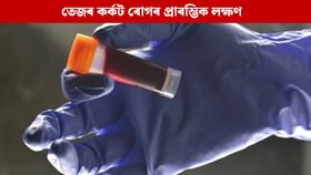 তেজৰ কৰ্কট ৰোগ হ'লে প্ৰথমে দেখা দিয়ে এইসমূহ লক্ষণ তেজৰ কৰ্কট ৰোগ হ'লে প্ৰথমে দেখা দিয়ে এইসমূহ লক্ষণ
