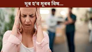 অত্যধিক মূৰৰ বিষৰ সমস্যাত ভুগিছে নেকি? এই সহজ উপায়ে দিব সকাহ, জানক…