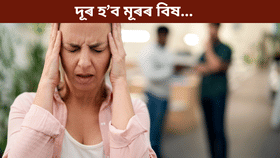 মূৰৰ বিষ কেনেকৈ দূৰ কৰিব? বাবা ৰামদেৱে দিলে সহজ উপায়... মূৰৰ বিষ কেনেকৈ দূৰ কৰিব? বাবা ৰামদেৱে দিলে সহজ উপায়...