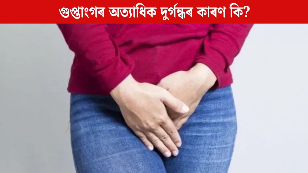 গুপ্তাংগৰ অত্যাধিক দুৰ্গন্ধ ওলায় নেকি? এয়া কি ৰোগৰ লক্ষণ জানক গুপ্তাংগৰ অত্যাধিক দুৰ্গন্ধ ওলায় নেকি? এয়া কি ৰোগৰ লক্ষণ জানক
