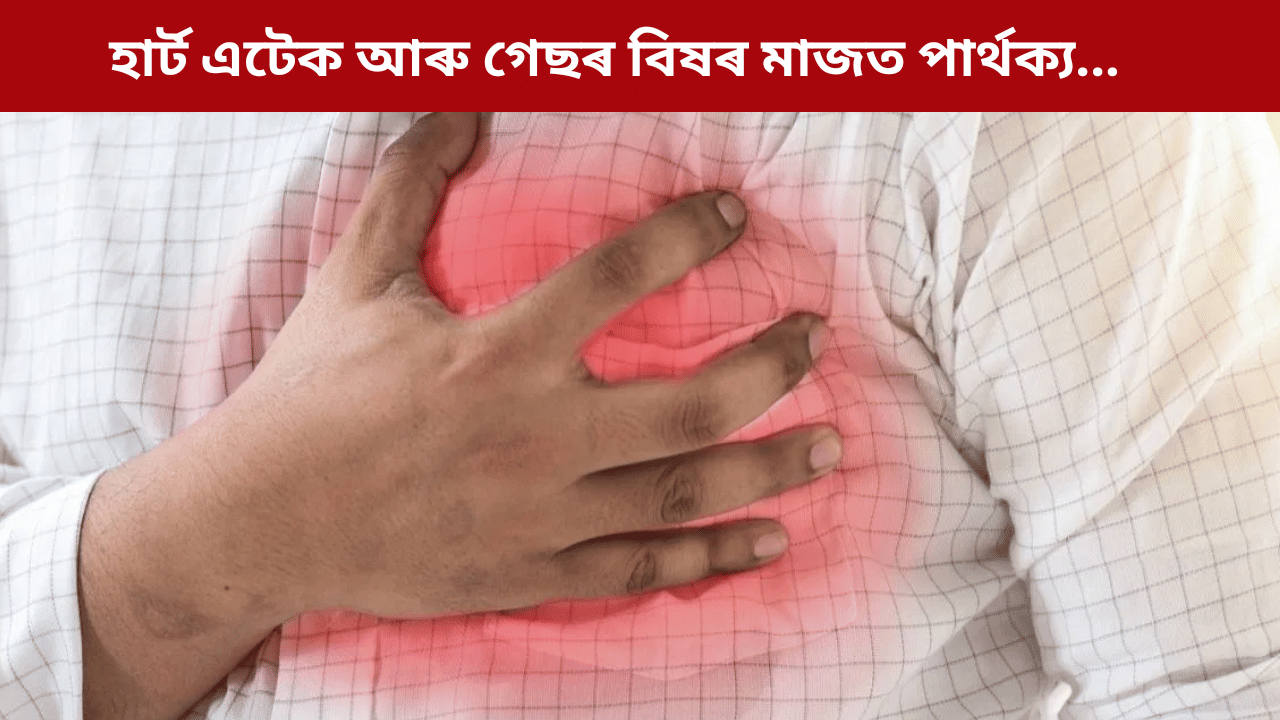 বুকুত বিষ হয় নেকি? কেনেকৈ জানিব এয়া হাৰ্ট এটেক নে গেছৰ বিষৰ লক্ষণ,  চিকিৎসকে জনালে সকলো…