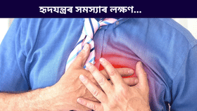 হৃদযন্ত্ৰৰ কাৰ্যক্ষমতা ৫০% হ্ৰাস পালে কি কি লক্ষণে দেখা দিয়ে?জানক হৃদযন্ত্ৰৰ কাৰ্যক্ষমতা ৫০% হ্ৰাস পালে কি কি লক্ষণে দেখা দিয়ে?জানক
