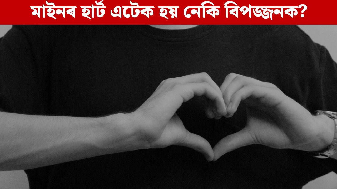 মাইনৰ হাৰ্ট এটেক হয় নেকি বিপজ্জনক? এনে লক্ষণ দেখিলেই হওক সাৱধান মাইনৰ হাৰ্ট এটেক হয় নেকি বিপজ্জনক? এনে লক্ষণ দেখিলেই হওক সাৱধান