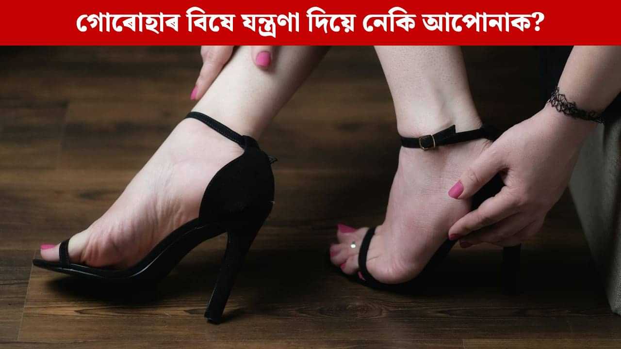 খোজ কঢ়াৰ সময়ত গোৰোহাৰ বিষে যন্ত্ৰণা দিয়ে নেকি? অপাৰেচন নকৰাকৈয়ে এনে উপায়েৰে পাব মুক্তি খোজ কঢ়াৰ সময়ত গোৰোহাৰ বিষে যন্ত্ৰণা দিয়ে নেকি? অপাৰেচন নকৰাকৈয়ে এনে উপায়েৰে পাব মুক্তি