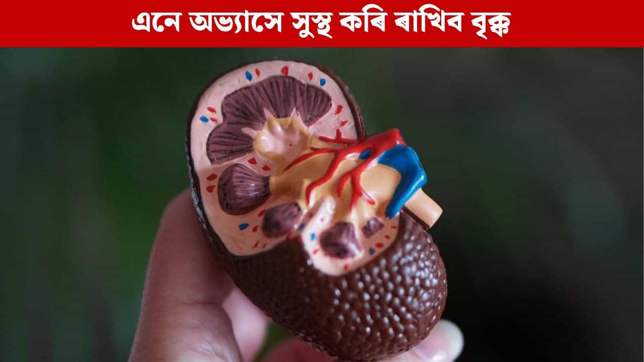 জীৱনশৈলীত ঘটাওক মাত্ৰ এই ৫টা পৰিৱৰ্তন; কিডনীক লৈ আপোনাৰ চিন্তা হ’ব দূৰ, হৈ থাকিব সুস্থ
