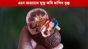জীৱনশৈলীত ঘটাওক মাত্ৰ এই ৫টা পৰিৱৰ্তন; কিডনীক হৈ থাকিব সুস্থ জীৱনশৈলীত ঘটাওক মাত্ৰ এই ৫টা পৰিৱৰ্তন; কিডনীক হৈ থাকিব সুস্থ