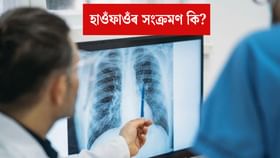 হাওঁফাওঁৰ সংক্ৰমণৰ লক্ষণসমূহ কি কি? বিশেষজ্ঞৰ পৰা জানক হাওঁফাওঁৰ সংক্ৰমণৰ লক্ষণসমূহ কি কি? বিশেষজ্ঞৰ পৰা জানক
