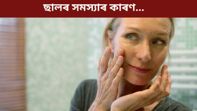 মহিলাৰ এই ৫টা অভ্যাসে ছাল অকালতে কৰি তোলে বৃদ্ধ... মহিলাৰ এই ৫টা অভ্যাসে ছাল অকালতে কৰি তোলে বৃদ্ধ...