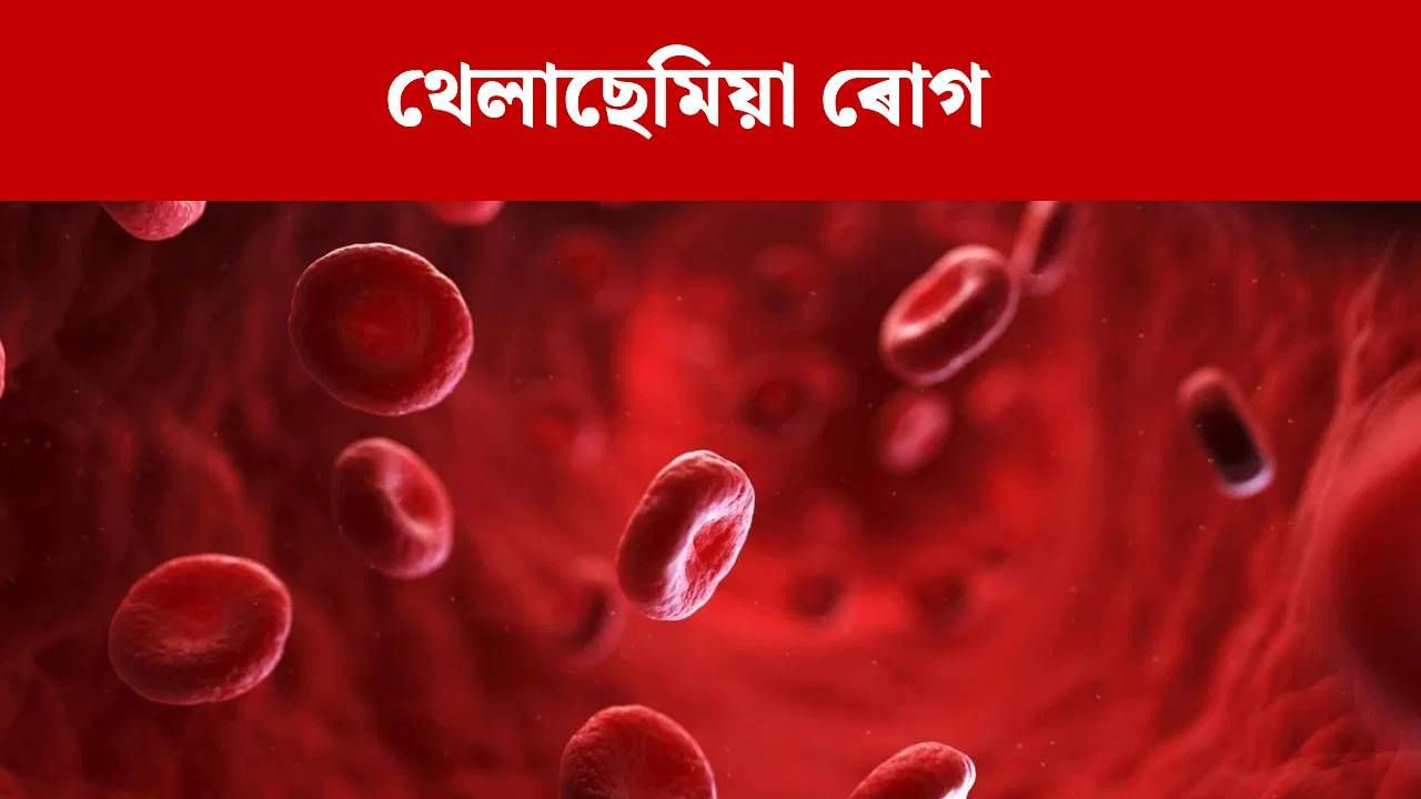 Thalassemia Disease