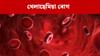 তেজৰ থেলাছেমিয়া ৰোগ কি? কাৰণ, প্ৰতিৰোধৰ উপায় জানক... তেজৰ থেলাছেমিয়া ৰোগ কি? কাৰণ, প্ৰতিৰোধৰ উপায় জানক......