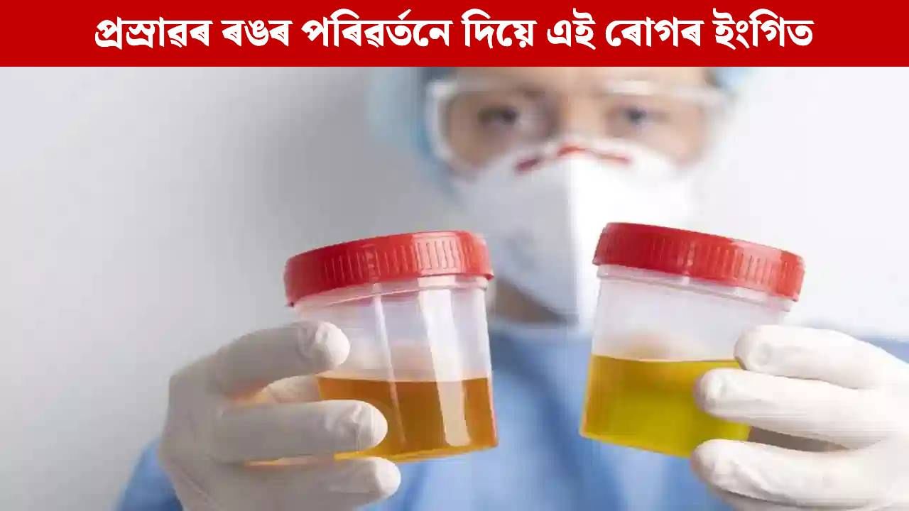 বাৰে বাৰে সলনি হৈছে নেকি প্ৰস্ৰাৱৰ ৰং? এয়া কি ৰোগৰ ইংগিত জানক…